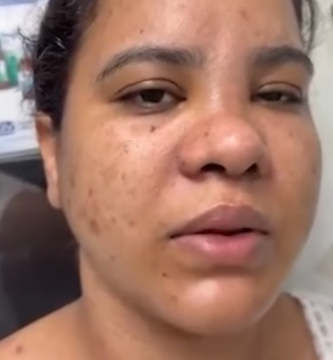 Arrestan hombre que provoco severos perjuicios a su pareja en Moca