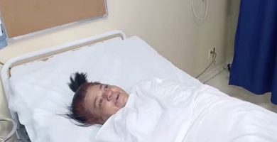 Hospital Ney Arias Lora realiza cirugía a mujer que tenía dos agujas en su cuerpo