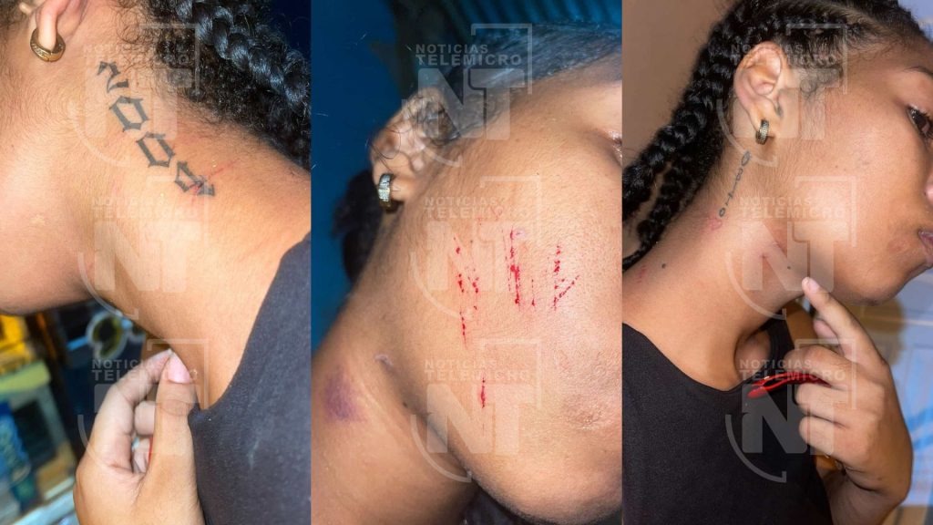 Joven embarazada denuncia inacción policial tras sufrir graves agresiones de su expareja en el Distrito Nacional