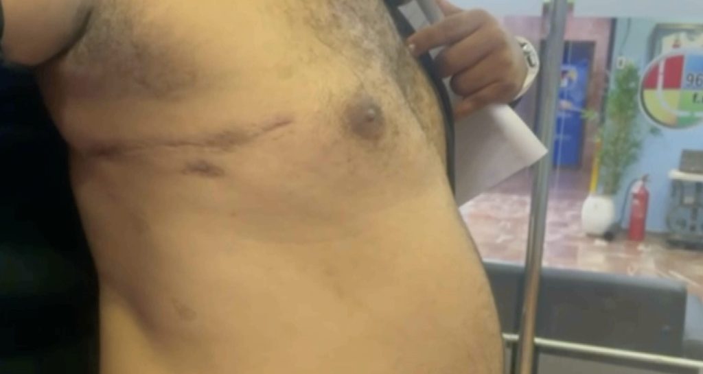 Hombre sobrevive con bala en el tórax y denuncia incumplimiento de ayuda económica
