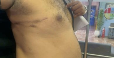 Hombre sobrevive con bala en el tórax y denuncia incumplimiento de ayuda económica