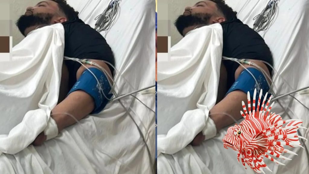 Joven es ingresado tras picadura de pez león durante rescate en Montecristi