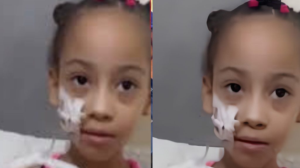Solicitan apoyo para trasladar a niña con síndrome de Berdon a hospital de Boston
