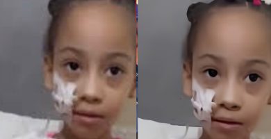 Solicitan apoyo para trasladar a niña con síndrome de Berdon a hospital de Boston