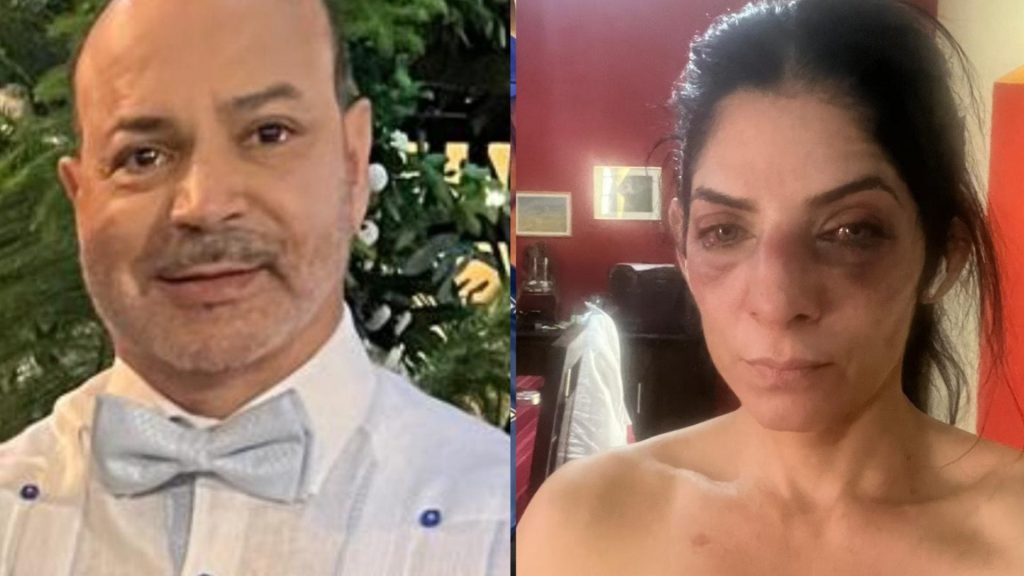 Caso de agresión en Jarabacoa: víctima cuestiona que su agresor siga libre