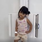 “Posando como modelo”: niña se vuelve viral durante estudio de rayos X