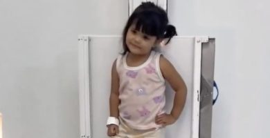 “Posando como modelo”: niña se vuelve viral durante estudio de rayos X