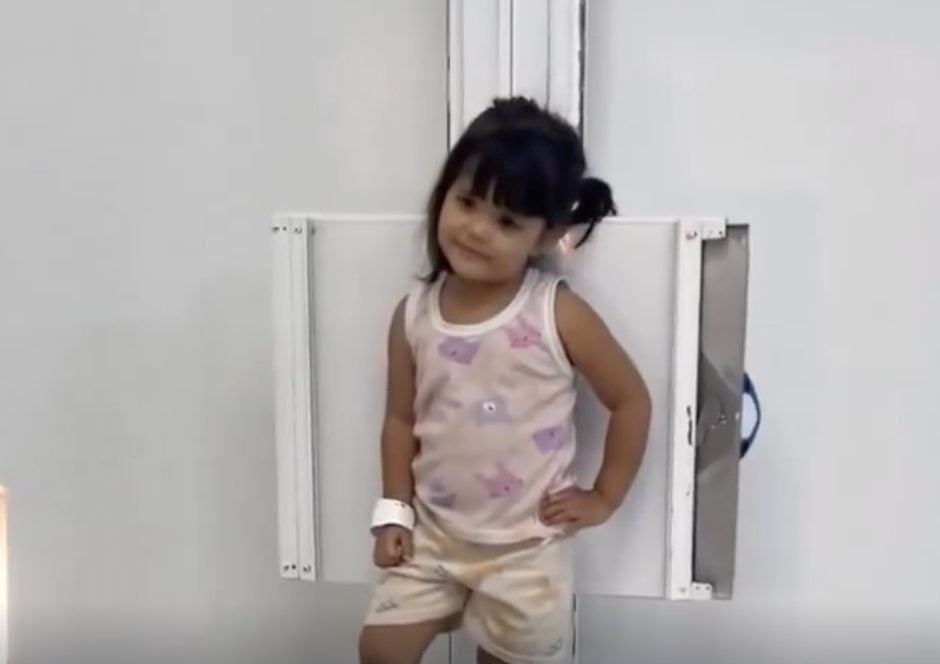“Posando como modelo”: niña se vuelve viral durante estudio de rayos X
