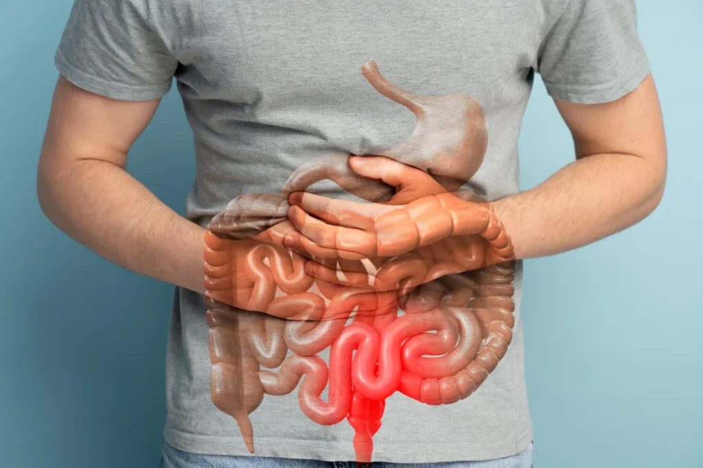 Más de 6 mil dominicanos padecen enfermedades inflamatorias intestinales