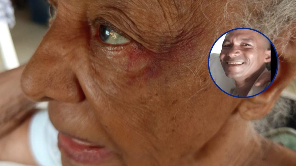Acusan a hijo de crianza de agredir a anciana de 83 años en Santo Domingo Norte