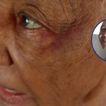 Acusan a hijo de crianza de agredir a anciana de 83 años en Santo Domingo Norte