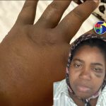 Maestra denuncia que ella, su esposo y su hijo fueron agredidos a batazos por una pareja en Higüey