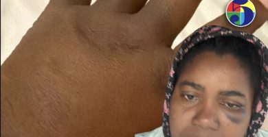 Maestra denuncia que ella, su esposo y su hijo fueron agredidos a batazos por una pareja en Higüey
