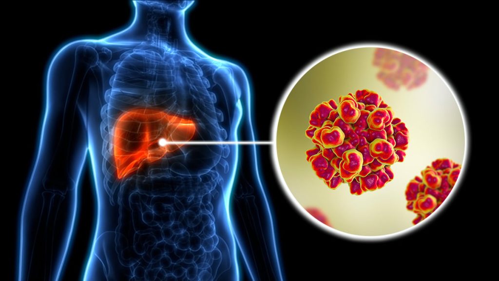 OMS advierte sobre casos de hepatitis con 1.3 millones de fallecimientos