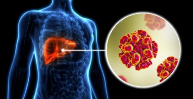 OMS advierte sobre casos de hepatitis con 1.3 millones de fallecimientos
