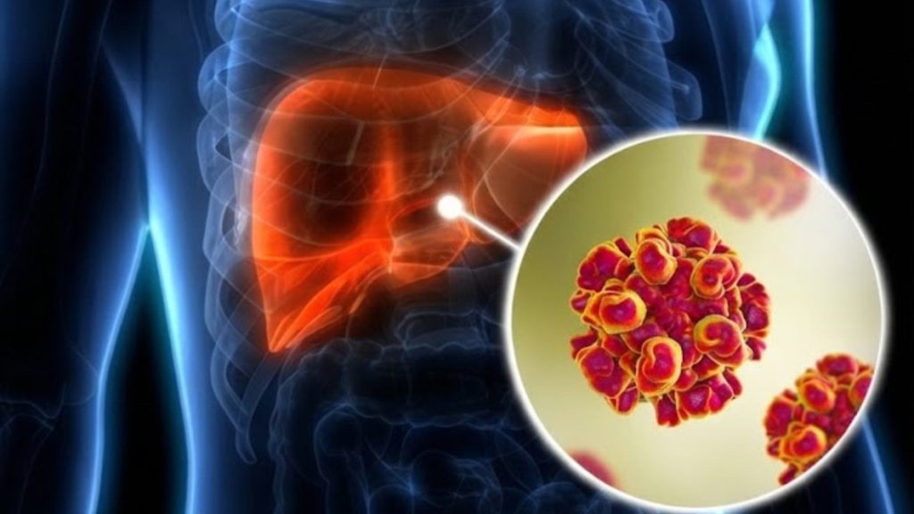 OMS: muertes por hepatitis siguen sin bajar, en contraste con el sida o la tuberculosis