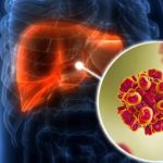 OMS: muertes por hepatitis siguen sin bajar, en contraste con el sida o la tuberculosis