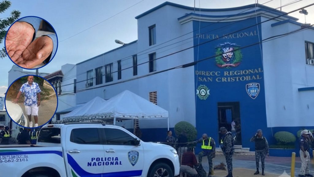 VIDEO: Casos de viruela símica fueron detectados en el mismo destacamento en el que se enfermó hombre detenido en San Cristóbal