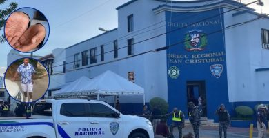 VIDEO: Casos de viruela símica fueron detectados en el mismo destacamento en el que se enfermó hombre detenido en San Cristóbal