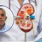 Solicitan ayuda urgente para hombre diagnosticado con cáncer renal con metástasis ósea