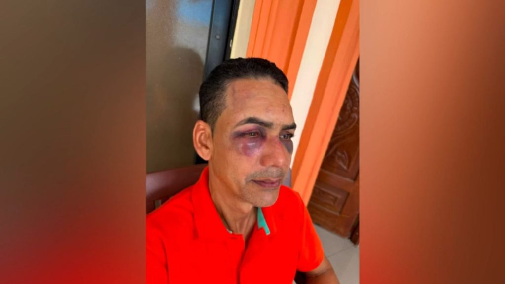 Hombre denuncia golpiza por parte de su hermano y su sobrino por una herencia en Azua