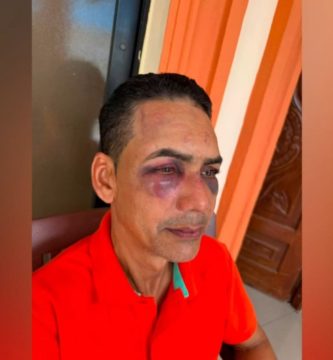 Hombre denuncia golpiza por parte de su hermano y su sobrino por una herencia en Azua