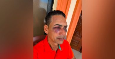 Hombre denuncia golpiza por parte de su hermano y su sobrino por una herencia en Azua