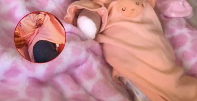 Denuncian presunta mala práctica tras amputación de brazo a recién nacida