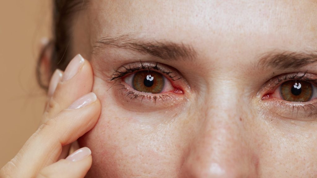 Altas temperaturas y aire acondicionado aumentan las consultas por ojo seco, alerta oftalmóloga