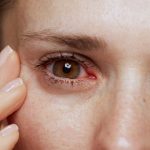 Altas temperaturas y aire acondicionado aumentan las consultas por ojo seco, alerta oftalmóloga