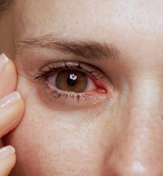 Altas temperaturas y aire acondicionado aumentan las consultas por ojo seco, alerta oftalmóloga