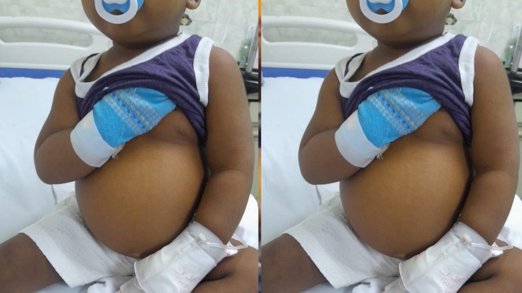 Familia pide ayuda para trasplante de hígado de niño de dos años