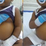 Familia pide ayuda para trasplante de hígado de niño de dos años