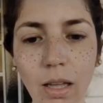 “Perdí trabajo y autoestima”: joven intentó hacerse pecas y denuncia daños tras procedimiento estético