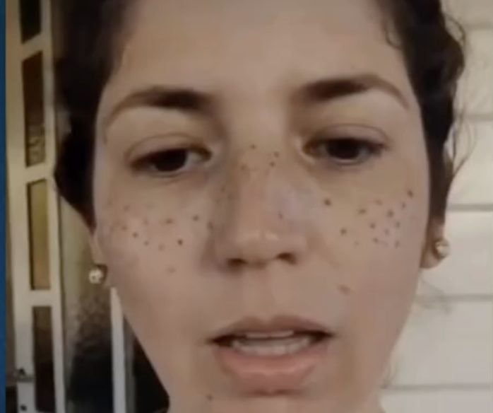 “Perdí trabajo y autoestima”: joven intentó hacerse pecas y denuncia daños tras procedimiento estético