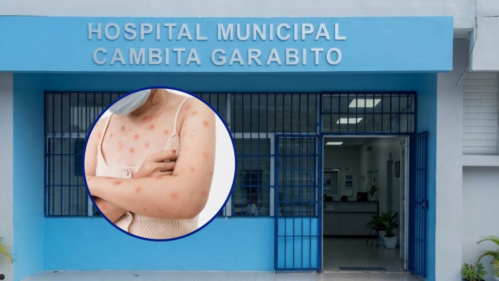 Desmienten que paciente con erupciones en la piel trasladada a hospital de Cambita tenga síntomas de viruela del mono