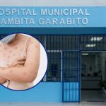 Desmienten que paciente con erupciones en la piel trasladada a hospital de Cambita tenga síntomas de viruela del mono