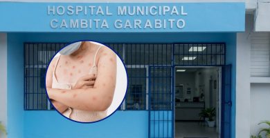 Desmienten que paciente con erupciones en la piel trasladada a hospital de Cambita tenga síntomas de viruela del mono